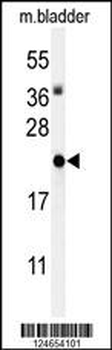 ID4 Antibody (N-term)