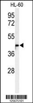 M11D1 Antibody (N-term)