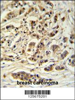 M11D1 Antibody (N-term)