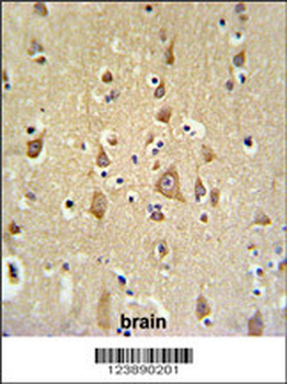FAM44B Antibody (C-term)
