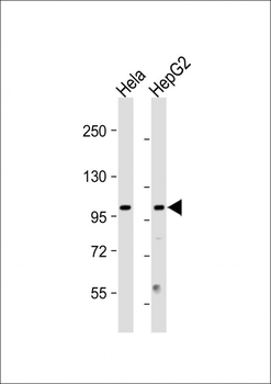 NUP210 Antibody (N-term)