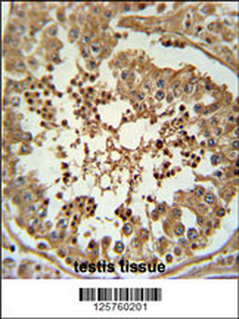 CC058 Antibody (Center)