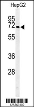 ARSI Antibody (C-term)