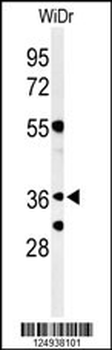 NSE4A Antibody (N-term)