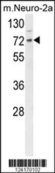 DNAJC2 Antibody (Center)