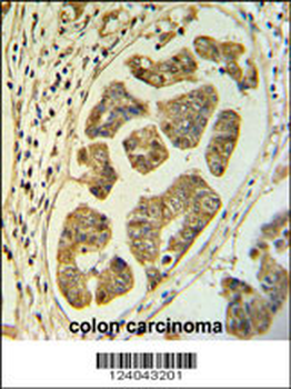 HCCS Antibody (Center)