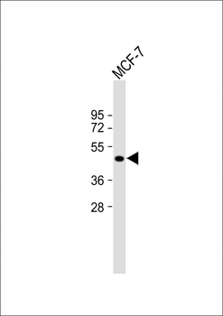 ETS2 Antibody (Center)