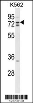 ZRANB1 Antibody (C-term)