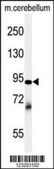 ZRANB1 Antibody (C-term)