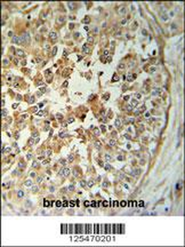 TM173 Antibody (C-term)