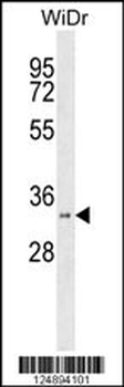 HSD17B11 Antibody (N-term)