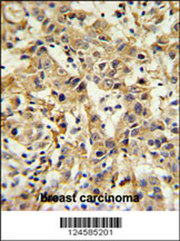 CA6 Antibody (C-term)