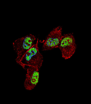 ZNF202 Antibody (Center)
