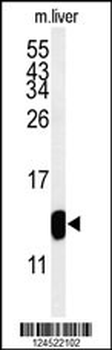 TMIE Antibody (Center)