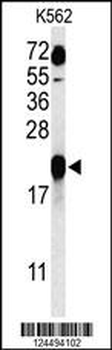 GAGE7 Antibody (C-term)