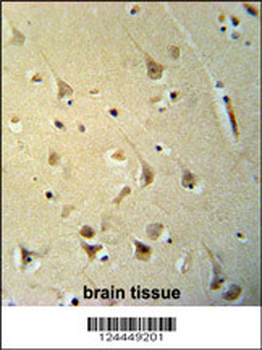 P2R3C Antibody (N-term)