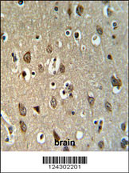 UPK1B Antibody (Center)