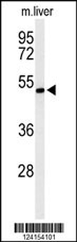 ZDHHC9 Antibody (C-term)