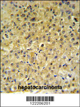 INSC Antibody (Center)