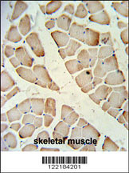 HFE2 Antibody (Center)