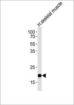 COX6A2 Antibody (Center)
