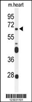 FZD4 Antibody (C-term)