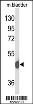 NPY2R Antibody (N-term)