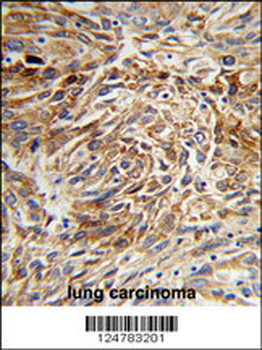 AGR3 Antibody (C-term)