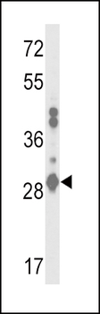 GSTA2 Antibody (N-term)