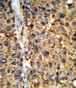 GSTA2 Antibody (N-term)