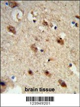 ACP1 Antibody (N-term)