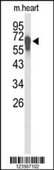 FBXL5 Antibody (N-term)