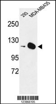 DIAPH2 Antibody (Center)