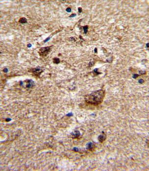 ADRA1B Antibody (Center)
