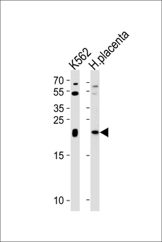 IL31 Antibody (N-term)