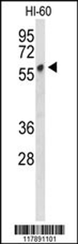 PLVAP Antibody (Center)