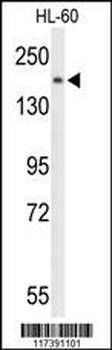 PLCB1 Antibody (C-term)