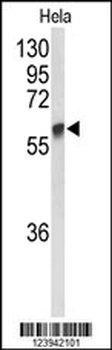 GALNT2 Antibody (N-term)