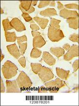 EYA4 Antibody (C-term)