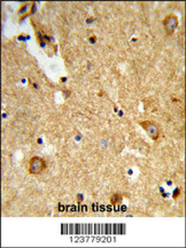 ENTPD2 Antibody (N-term)