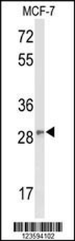 DAGLB Antibody (Center)