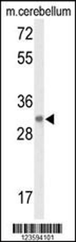 DAGLB Antibody (Center)