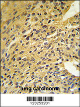 COQ5 Antibody (Center)