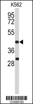 DFFA Antibody (C-term)