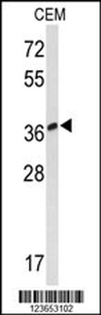 MTNR1A Antibody (Center)