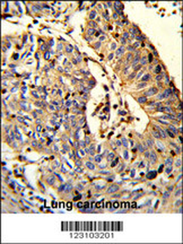 TSPEAR Antibody (Center)