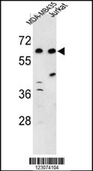 CBARP Antibody (Center)