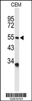 ACCN2 Antibody (C-term)