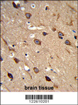 ACCN2 Antibody (C-term)