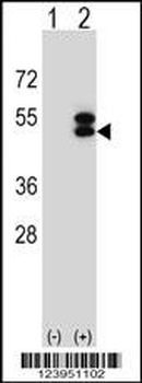 ATXN3 Antibody (Center)